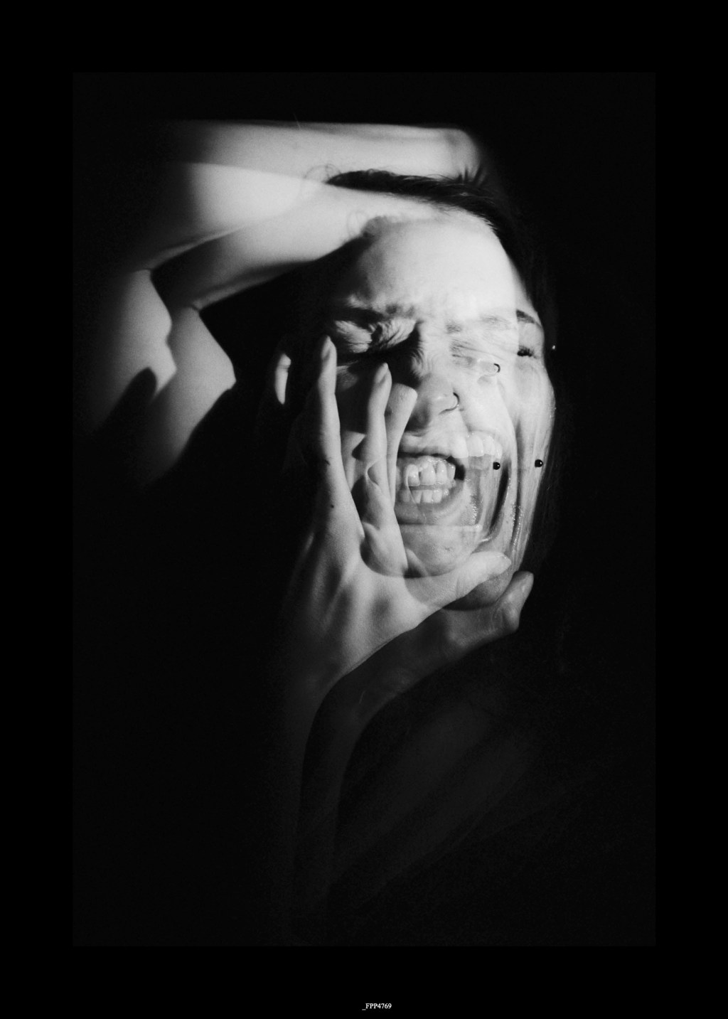 Epilepsie oder dissoziative&nbsp;Krampfanfälle?